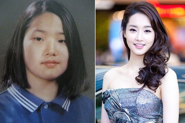 Park Min Young trước và sau